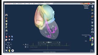 Introductory lecture on Epicardio Simulation™  ECG [upl. by Phare]