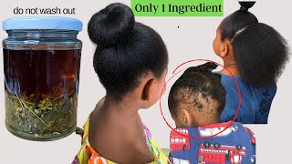 DIY Overnight Hair Regrowth Spray  रात को सोने से पहले बस 5 Mins लगा लें और पाएं कमाल की Growth❤️ [upl. by Sellihca]