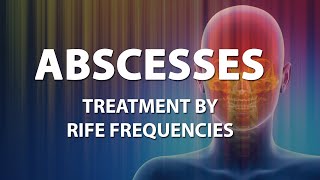 Abscesses  RIFE Frequencies Treatment  Energy amp Quantum Medicine with Bioresonance [upl. by Dekow]