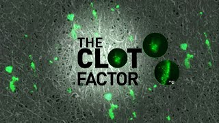 The Clot Factor  Full Measure [upl. by Klump773]