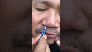 Nose hair removal [upl. by Airad]