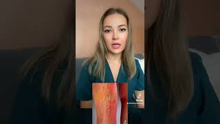 🕸️Venele Varicoase Simptome🔍 doctor varice preventie medicina tiktok trending best new [upl. by Nospmoht]