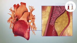 The evolution of oral anticoagulants [upl. by Ecnahc460]