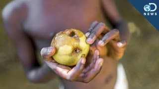 Why Malnourished Children Might Never Recover [upl. by Janek641]