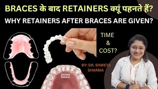 Retainers After Braces in Hindi Cost Time Why Retainers Are Important [upl. by Nelaf]