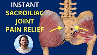 Understand SI Joint Pain and EXERCISE for Relief [upl. by Annahtur]