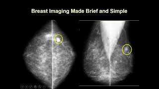 Introduction to Mammography  Radiology Basics  Ultrasound Imaging Technique [upl. by Dnalwor]