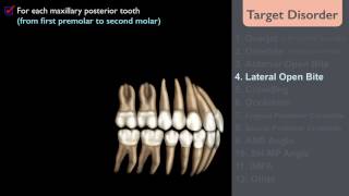 CC402 2017 ABO Discrepancy Index DI by Chris Angle Lee Part 1 [upl. by Melleta]