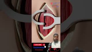 Tracheostomy 3danimationsurgery satisfying medicalanimation trachea doctor anatomy facts [upl. by Lesya728]