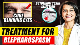 Blepharospasm and Botulinum Toxin Injections  Botulinum Toxin Mechanism of Action  Dr Rwituja [upl. by Drooff]