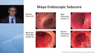 What Determines “Quality” for Endoscopy Reporting in IBD Patients [upl. by Llerrut803]