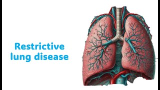 Enfermedades restrictivas pulmonares [upl. by Onirotciv]