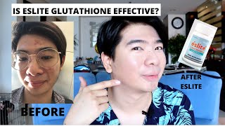 ESLITE SACETYL GLUTATHIONE REVIEW  ALTERNATIVE TO IV THERAPY  PUMUTI AT KUMINIS 30 DAYS OF USE [upl. by Oflunra]