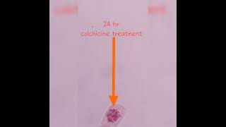 video showing cells at different phases of cell division and a cell after colchicine treatmentlife [upl. by Karla]