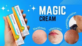 Skinoren Cream 20 Azelic Acid Cream  Honest Review  Hyperpigmentation  Blackheads  Acne Scars [upl. by Ahsiram465]