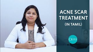 Best Treatment For Acne Scars And Pimple Marks Tamil  முகபரு வடு விடுபட [upl. by Nedarb]