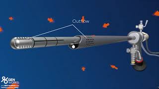 Truclear hysteroscopic tissue removal system [upl. by Allanson]