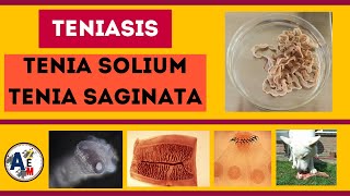 TENIASIS  Taenia solium y saginata [upl. by Ybloc67]