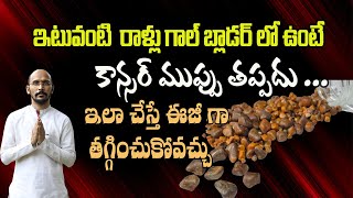 ఇటువంటి రాళ్లు గాల్ బ్లాడర్ లో ఉంటే కాన్సర్ ముప్పు తప్పదు   DrMadhu Babu Health Trends [upl. by Imoyn]