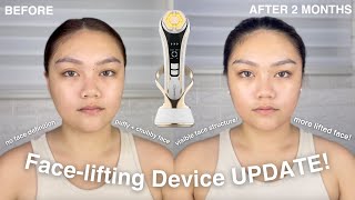 2 MONTH UPDATE ON THE FACELIFTING DEVICE  Bare Basics Revive Review [upl. by Phira356]