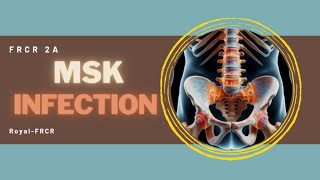 9  MSK amp Trauma Imaging for FRCR [upl. by Aneekat359]