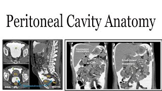 Peritoneal cavity anatomy [upl. by Daveta516]