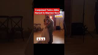 Abby Hensel One of the Conjoined Twins Gets Married viral abby trending [upl. by Ellehcil]