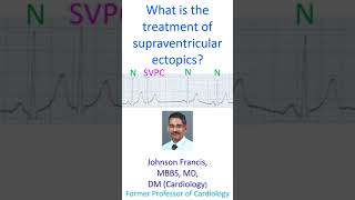 What is the treatment of supraventricular ectopics [upl. by Dyan790]