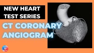 What is a CT Coronary Angiogram  CTCA [upl. by Jadd]