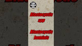 🤔Blastocystis Hominis en Heces Es un QuisteForma Vacuolar ¿Que es Morfologia e Identificacion🔬p2 [upl. by Lazor204]