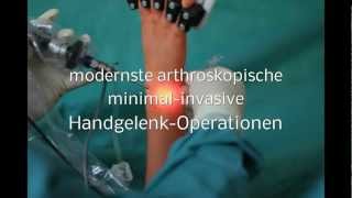 ARTHROSKOPISCHE HANDGELENK OPERATION minimal invasive Handgelenksoperation Handgelenk Op [upl. by Eenhpad]