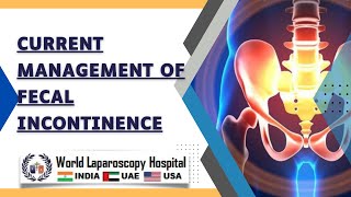 Current management of fecal incontinence [upl. by Byrdie]