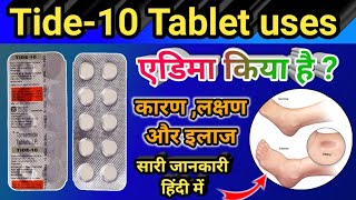 Tide10 Tablet use in hindi  Tide10 की पूरे जानकारी हिंदी में एडिमा रोग की बेस्ट टेबलीट्स 🔴 [upl. by Llednor291]