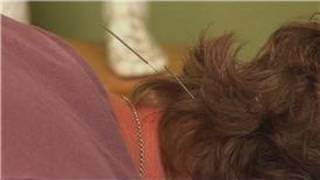 Acupuncture Treatments  Acupuncture for Neck Pain [upl. by Kat]