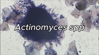 Actinomyces spp [upl. by Jandy34]