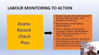 labor care guide time to change from Partogram to Labor care guide by WHO Dr Prof ArunaNigam [upl. by Adran]