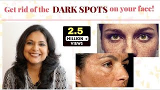 Best Remedies for Hyperpigmentation in 5 minutes  Dermatologist Solutions  ZindagiWithRicha [upl. by Adnohsed628]