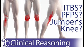 Atraumatic Knee Pain Differential Diagnosis  ITBS PFPS Jumpers Knee [upl. by Gnourt]