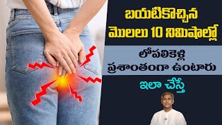 Home Remedies for Piles  Get Rid of Hemorrhoids  Pain Relief  Manthenas Health Tips [upl. by Mushro549]