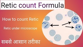 Retic count formula [upl. by Allak710]