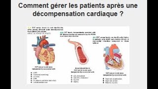 Comment gérer les patients après décompensation cardiaque [upl. by Koo970]