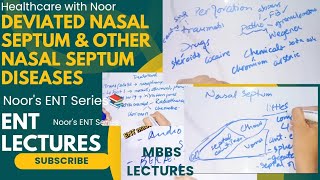 deviated nasal septum  disorders of nasal septum  nasal septum diseases  DrNajeebLecturesJr [upl. by Gisela95]