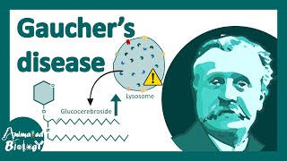 Gauchers disease  classification symptoms pathology of Gauchers disease [upl. by Cirdec]