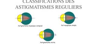 BIOPHYSIQUE Astigmatisme [upl. by Freda]