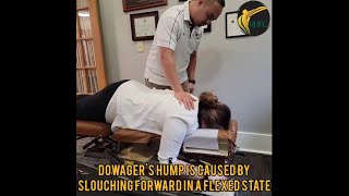 Chiro Treatment for Dowagers Hump [upl. by Eninej]