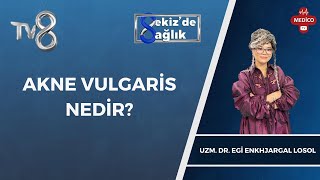 Akne Vulgaris Nedir  Uzm Dr Egi Enkhjargal Losol  8de Sağlık [upl. by Lancelle523]