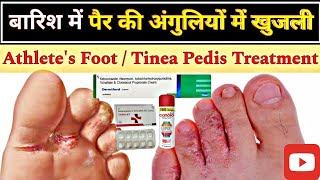 इस समय बारिश में पैर की उंगलियों में खुजली होना  Tinea Pedis Treatment  Athlete Foot  Medicine [upl. by Lledrev]