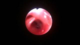 Veterinary Bronchoscopy413 Mild interstitial pneumonia MDachshund 13y F [upl. by Haze106]