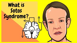 What is Sotos Syndrome made incredibly EASY [upl. by Merci595]