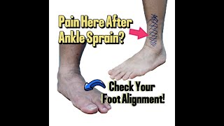 After Ankle Sprain and Surgery Check Your Foot Alignment [upl. by Hebert133]